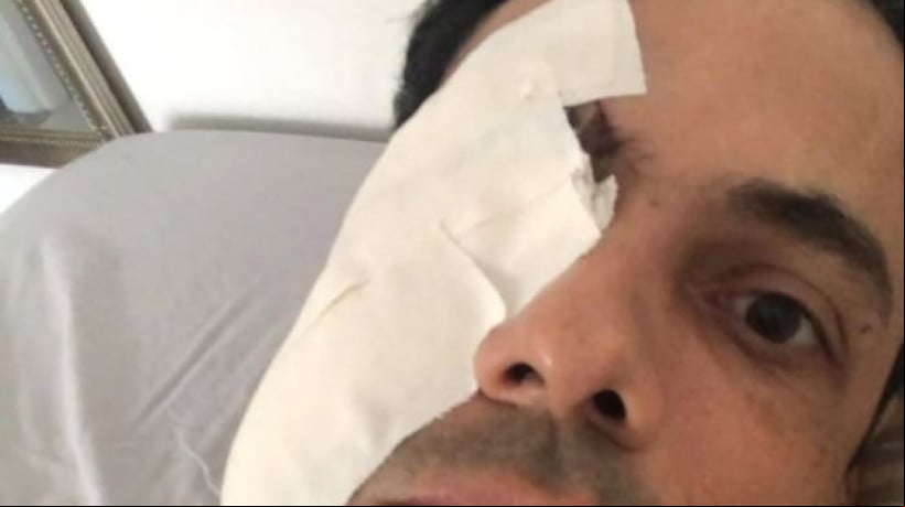 O empresário Bruno Rugue foi agredido enquanto trabalhava em um evento. A Polícia Civil investiga o caso
